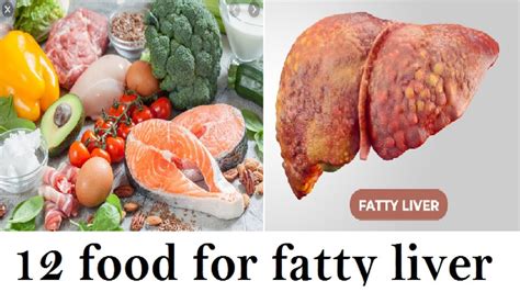 12 foods to help #fatty #liver #disease reversal | 6 foods to avoid if ...