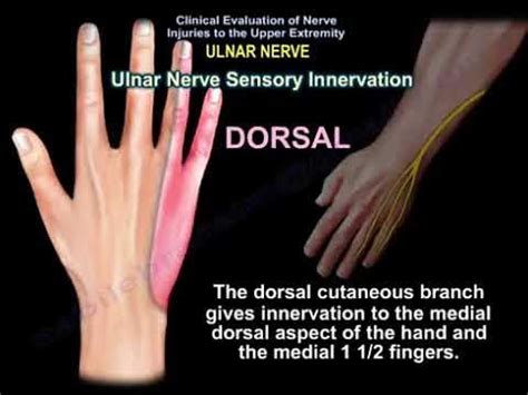 ULNAR NERVE INJURY ,CAUSES ,SYMPTOMS ,DIAGNOSIS AND TREATMENT. Cubital tunnel syndrome. - YouTube