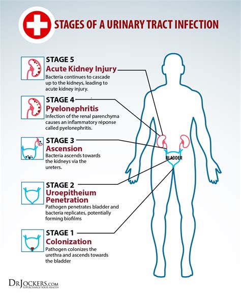 5 Phases to Heal UTIs Naturally - DrJockers.com Urinary Tract Infection Treatment, Remedies For ...