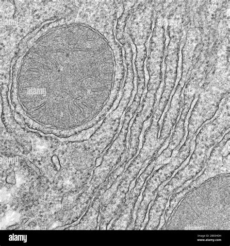 Mitochondria Electron Micrograph Labelled