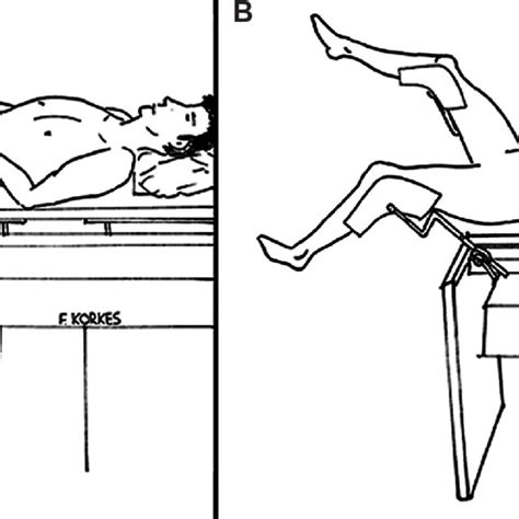 Patient position during left ureteroscopy: A) Dorsal lithotomy ...