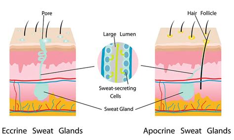 Clogged Armpit Sweat Glands? Here’s How to Manage Them - MiraDry Miami