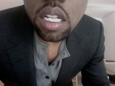 ngelumot: Kanye West's Diamond Dental Work