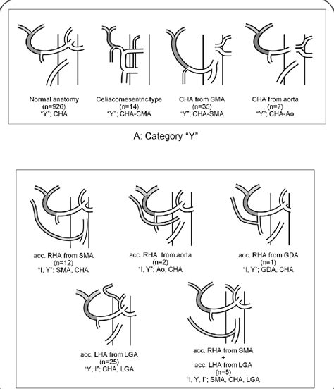 New clinical classification of anatomic variations of hepatic arteries... | Download Scientific ...