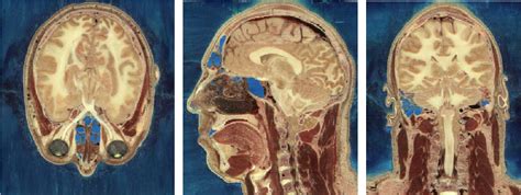 Biomechanical Phenomena | Semantic Scholar