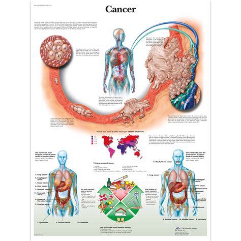 Anatomical Charts and Posters - Anatomy Charts - Pathology Charts ...