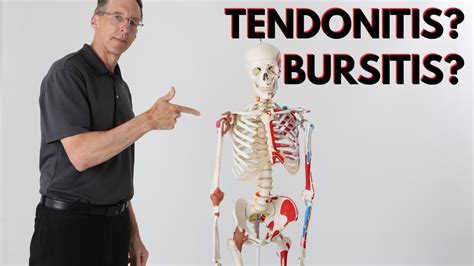 Does Tendonitis Hurt To Touch? Trust The Answer - Musicbykatie.com