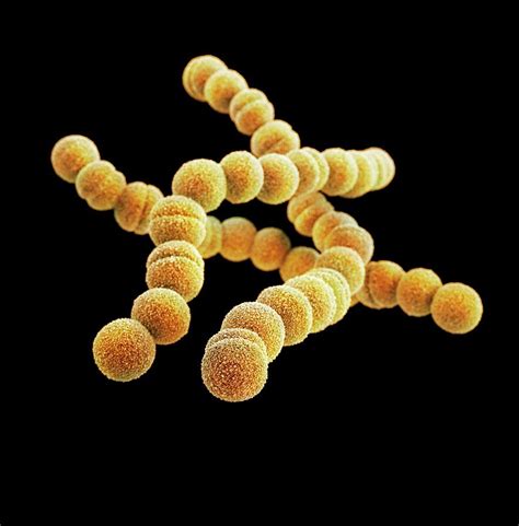 Streptococcus Pyogenes Bacteria #1 Photograph by Science Photo Library ...