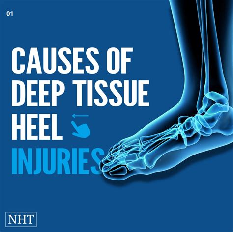 Deep Tissue Injury Heel - Medical & Legal Analysis **(2023)**