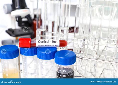 Cortisol Test To Look for Abnormalities from Blood Stock Image - Image of doctor, laboratory ...