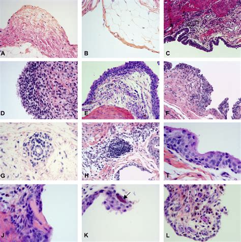 Synovial Membrane Histology