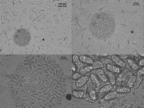 Figure 1 from Acquisition and transmission of Hepatozoon canis ...