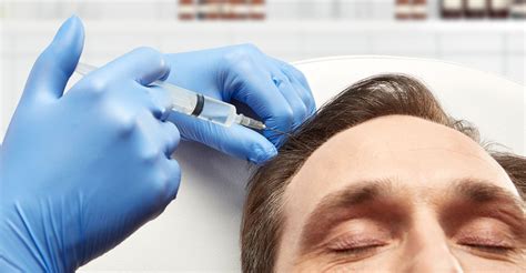 Non-Surgical Hair Restoration: Understanding the Basics of PRP Therapy ...