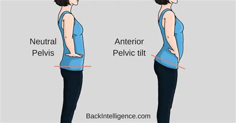 How To Fix Anterior Pelvic Tilt Posture - 10 Exercises | Back Intelligence