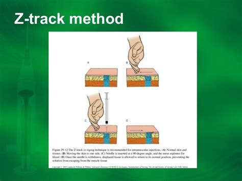 Injection Presentation