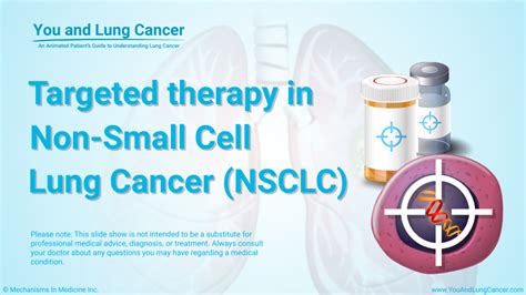 Slide Show - Targeted Therapy in Non-Small Cell Lung Cancer