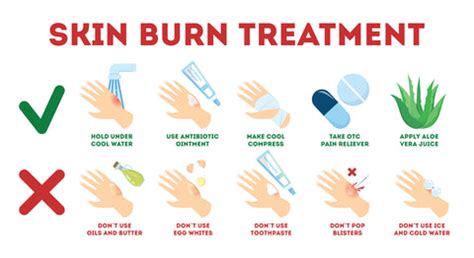 How To Cure Small Burns - Theatrecouple12