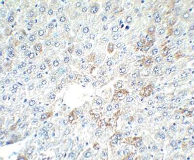 alpha-Fetoprotein/AFP Antibody - BSA Free (NBP1-76275): Novus Biologicals