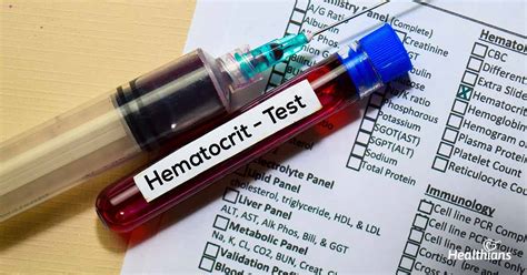 PCV Hematocrit Test – The Need And The Meaning Of Results