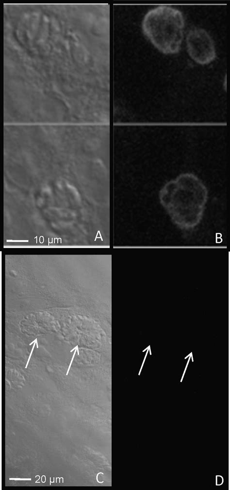 Light microscopy images showing the conversion of tachyzoites to... | Download Scientific Diagram