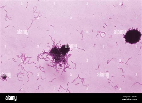 Mutans hi-res stock photography and images - Alamy