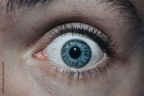 Close up of Surprised Scared Look. Close up of Eye. Blue Eye with Veins. Stock Photo | Adobe Stock