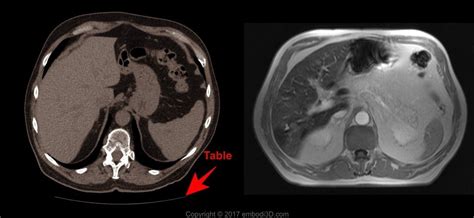 Difference Between Cat Scan And Mri Images - the meta pictures