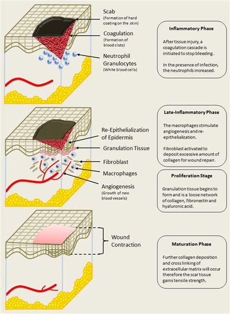 Wound Healing Diagram