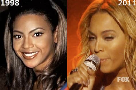 Naija Gossipsoeurs: DID BEYONCE HAVE A NOSE JOB?