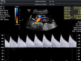 OBSTETRIC ULTRASOUND - SMC OB-GYNE ULTRASOUND CLINIC