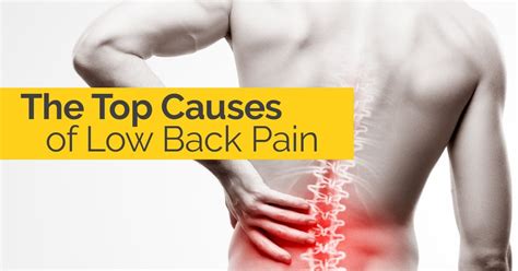 Low Back Pain Pictures: Symptoms, Causes, Treatments