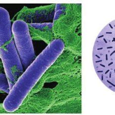 -Clostridium botulinum | Download Scientific Diagram