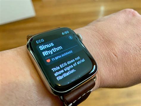 ECG Apple Watch App: The Ultimate Guide | iMore