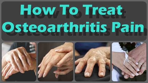 How to Prevent and Treat Osteoarthritis in the Hands And Osteoarthritis Diagnose - YouTube