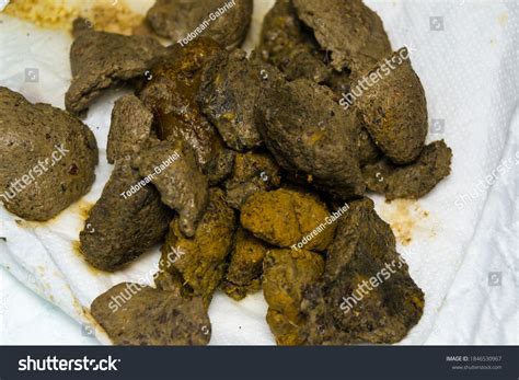 Close-up Photo Fecal Impaction Constipated Cat Stock Photo 1846530967 ...