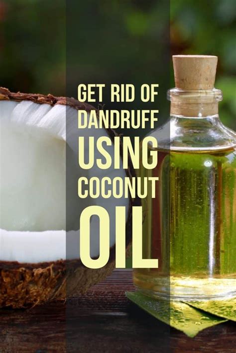 How to Get Rid of Dandruff using Coconut Oil