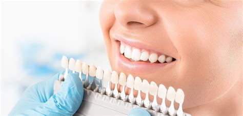 Teeth Whitening - Cosmetic Dental Clinic Near Me - Bay Harbor, FL ...