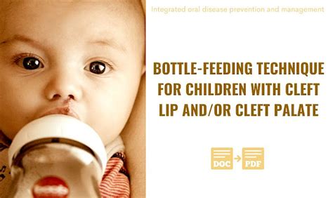 PDF: Bottle-feeding technique for children with cleft lip and/or cleft ...