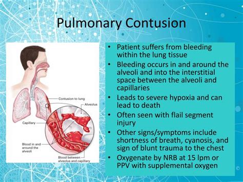 PPT - Chest Trauma PowerPoint Presentation - ID:5319182