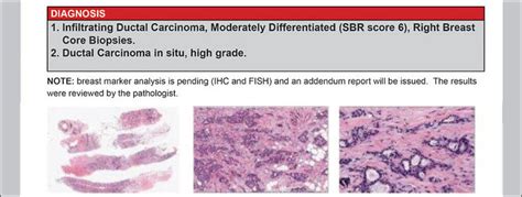 How to Read Your Pathology Report - Your Pathologist