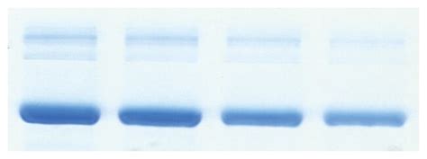 Zeba™ Micro Spin Desalting Columns, 40K MWCO, 75 µL