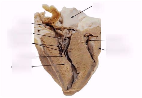 sheep heart anatomy Diagram | Quizlet