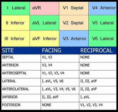 MI ecg and affected vessels | Paramedic student, Icu nursing, Telemetry nursing