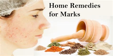 Home Remedies for Acne Marks Treatment