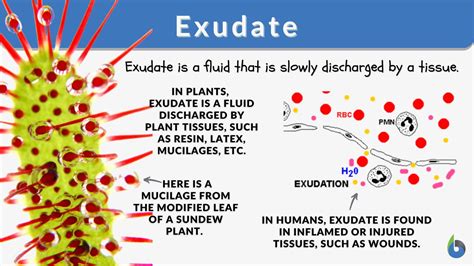 Fibrinous exudate - Definition and Examples - Biology Online Dictionary