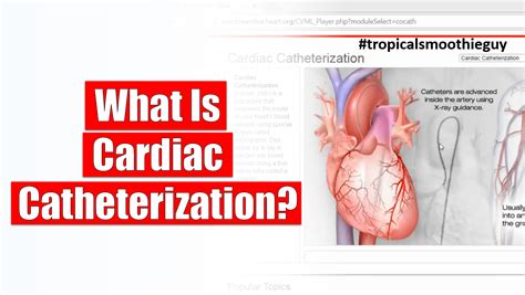 What Is Cardiac Catheterization?