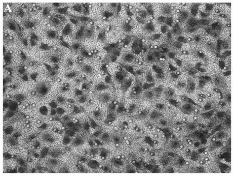 CADM1/TSLC1 inhibits melanoma cell line A375 invasion through the ...