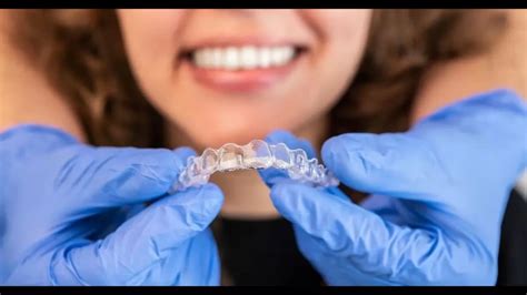 Byte Aligners Reviews: Cost, Results, And Discounts