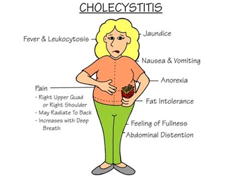 Acalculous Cholecystitis Diagnosis