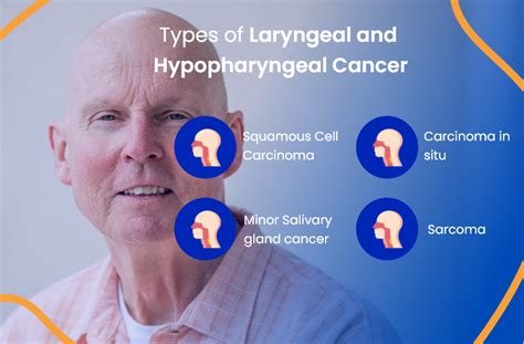 Hypopharyngeal Cancer